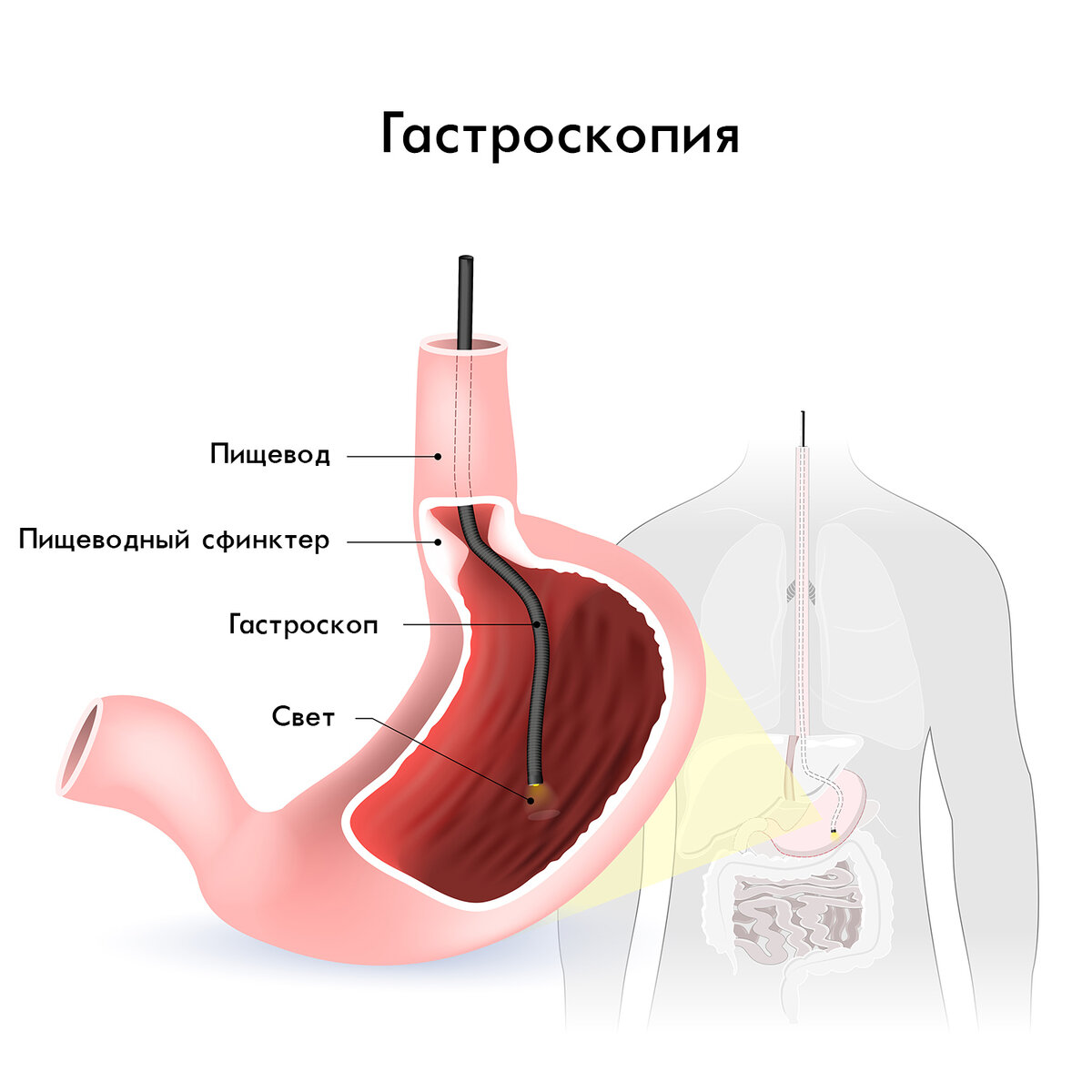https://resursor.ru/wp-content/uploads/2017/07/skhematichnoe-izobrazhenie-anatomii-zheludka-i-provedenie-gastroskopii.jpg