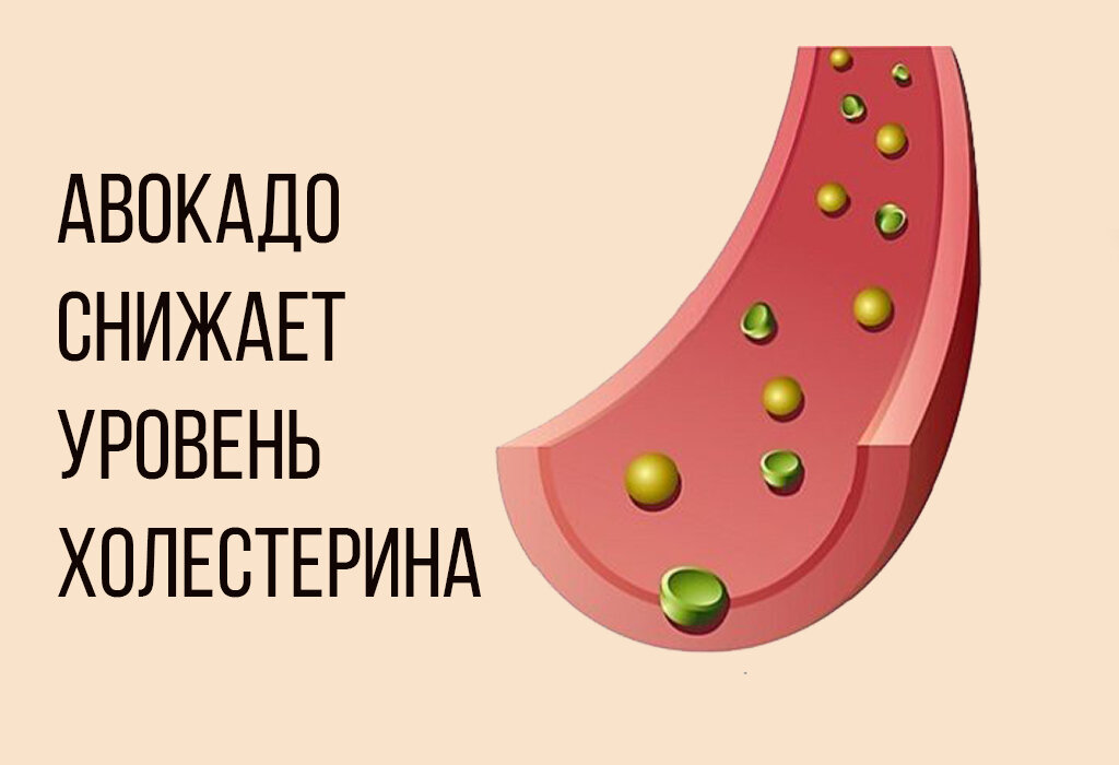 Авокадо каждый день. HDL cholesterol= 2.18.