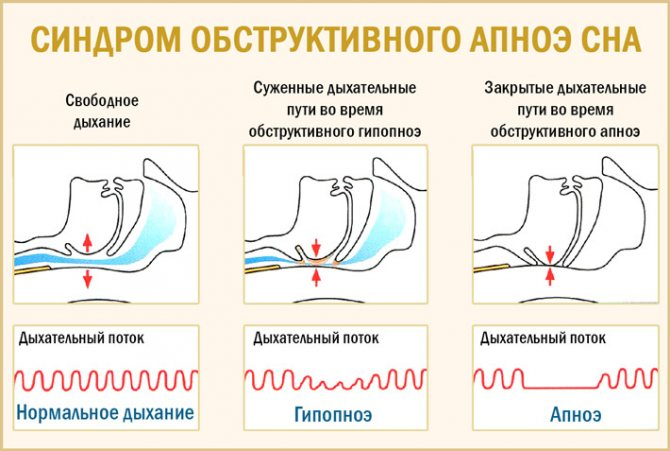 Причины хронической усталости