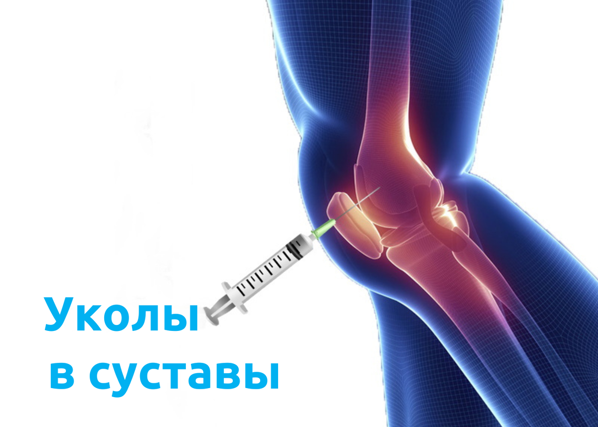 15 уколов. шприц укол метотрексат эбеве 15мг. ипигрикс 15мг/мл 1,0 мл амп 10шт гриндекс рус. лекарство нейромидин уколы. аксамон ампулы.