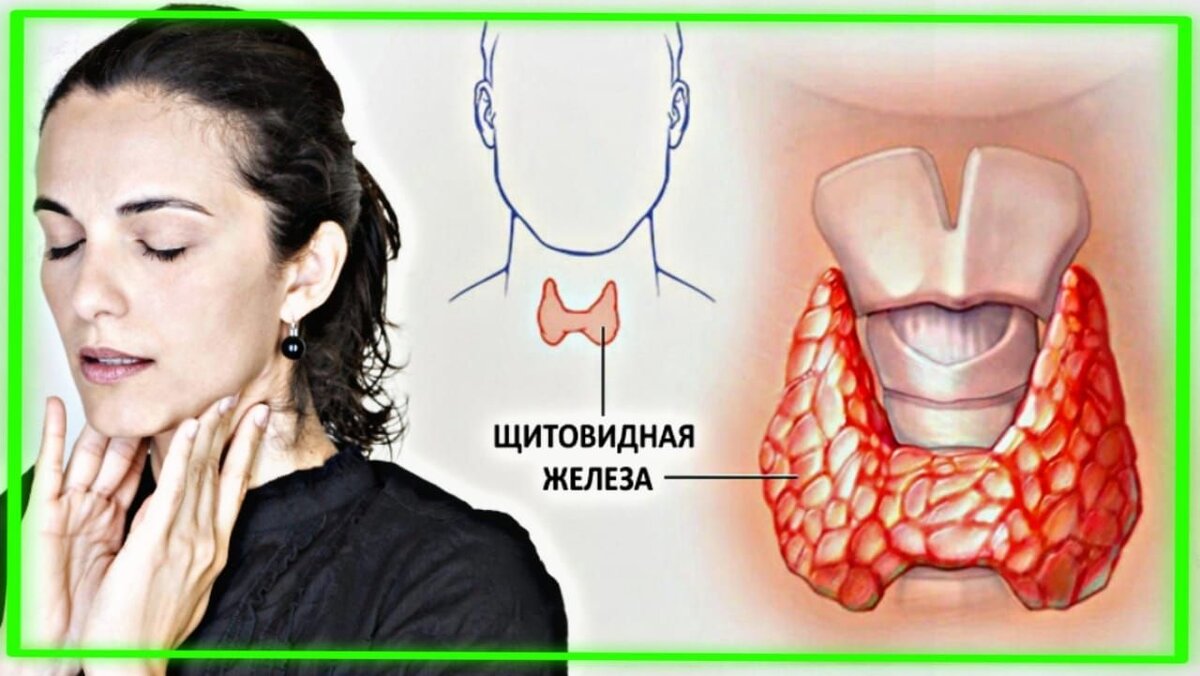 🍃Щитовидная железа и ее значение в организме

🔻Щитовидная железа – это небольшой орган, расположенный на передней поверхности шеи в нижней ее части, весом 15-20 грамм.

 Названа железа так потому, что расположена перед щитовидным хрящом гортани. Она имеет две доли, соединенные перешейком.

🔻Щитовидная железа вырабатывает тиреоидные гормоны – тироксин и трийодтиронин, которые, выделяясь в кровь, оказывают влияние на все клетки и ткани организма, регулируют скорость различных процессов обмена веществ. 

🔻Эти гормоны отвечают за множество жизненно важных функций: они регулируют деятельность головного мозга, нервной и сердечно-сосудистой системы, желудочно-кишечного тракта, влияют на репродуктивную функцию, работу молочных и половых желез и много другое.