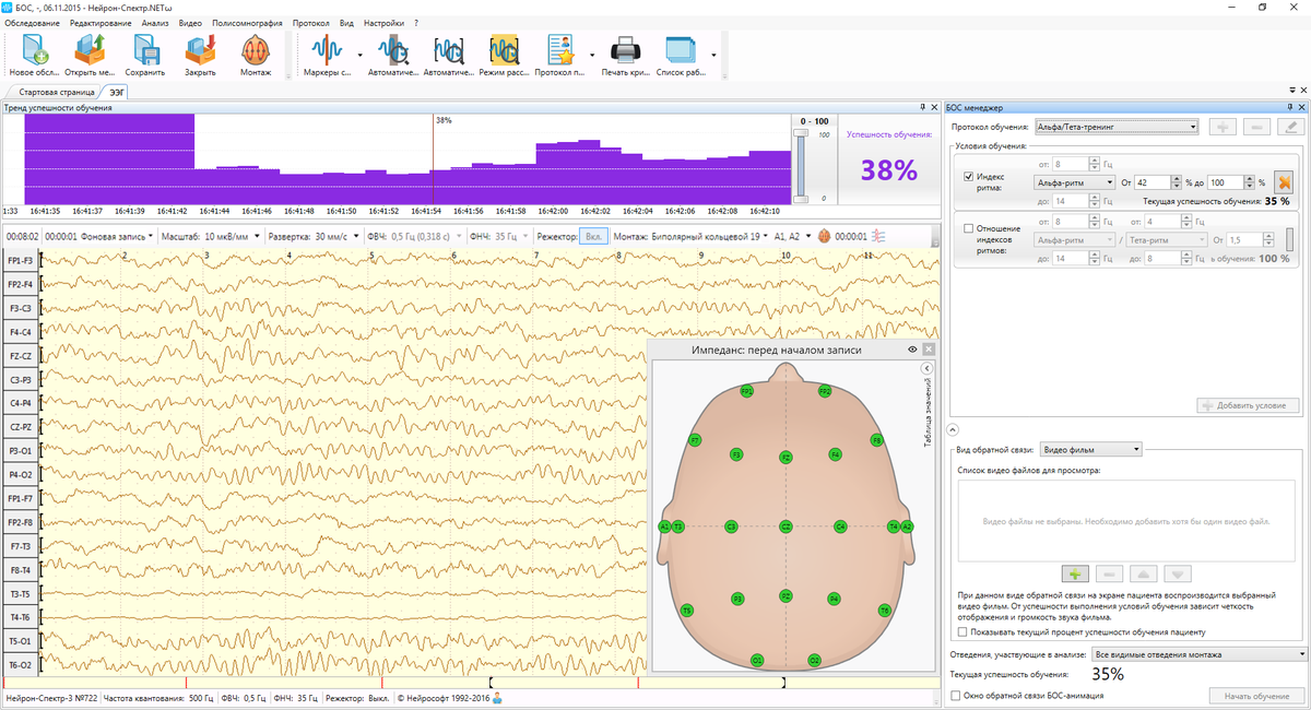 Бос схема. ЭЭГ аппарат Нейрон спектр 3. Электроэнцефалограф 32-канальный Нейрон-спектр-5. Прибор Нейрон спектр 2 энцефалограммы. Аппарат ЭЭГ Нейрософт.
