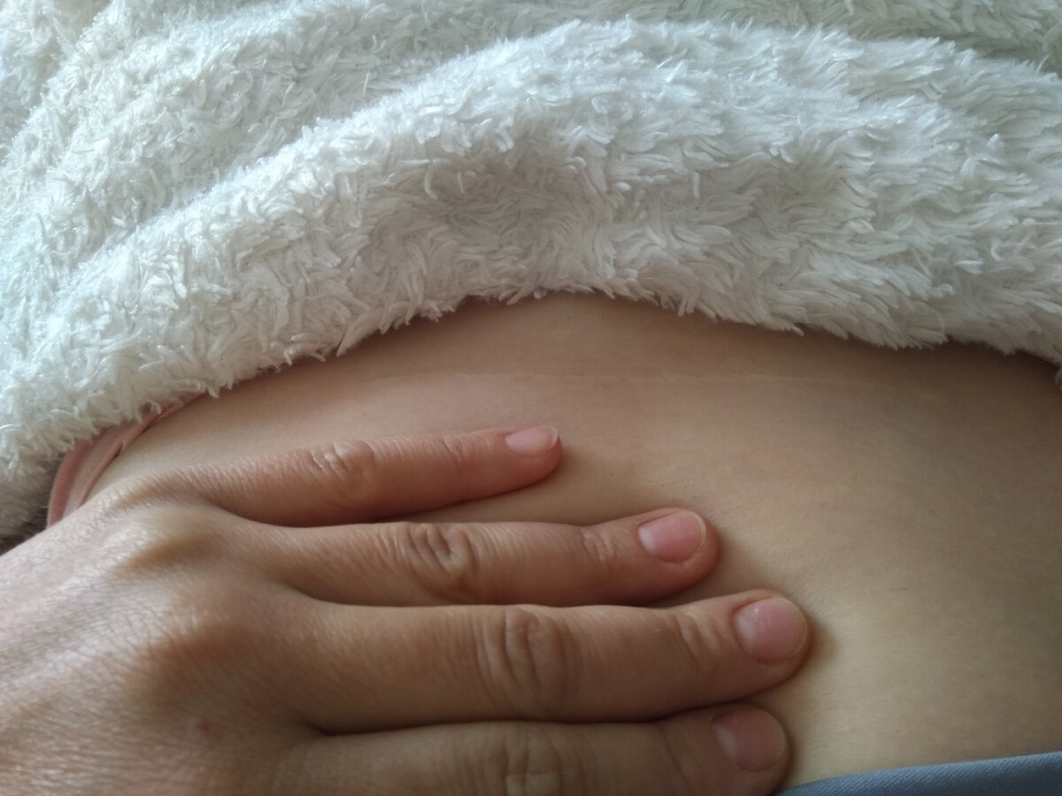 Шов, спустя 6 лет.