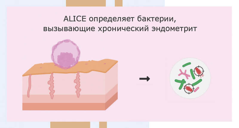 П. Алиса программирование. Тест emma. Алиса тест. Элис тест.