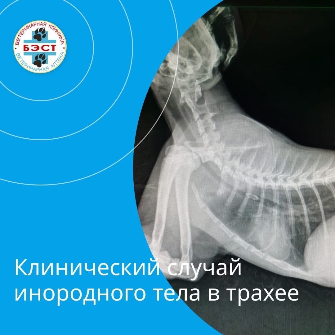 Результаты рентгена