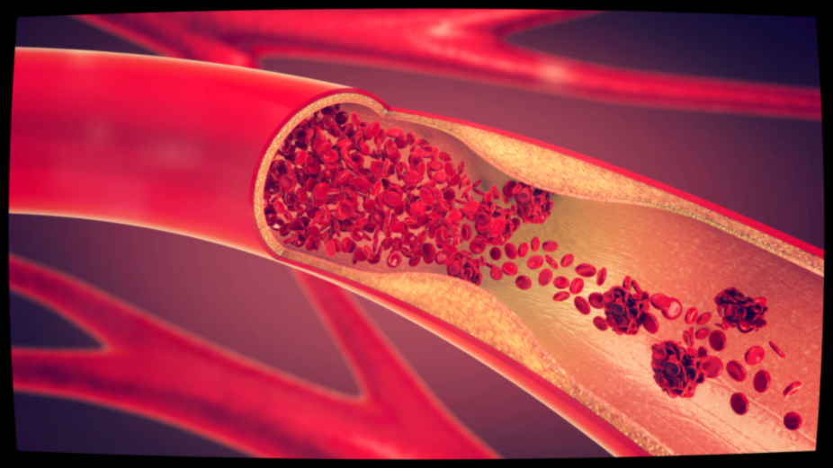 Сохранить эластичность  сосудов можно!