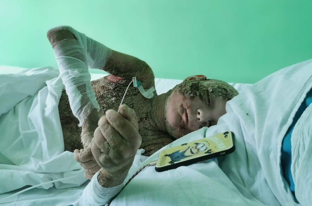 Кирилл Перчик, подопечный фонда "Алёша"