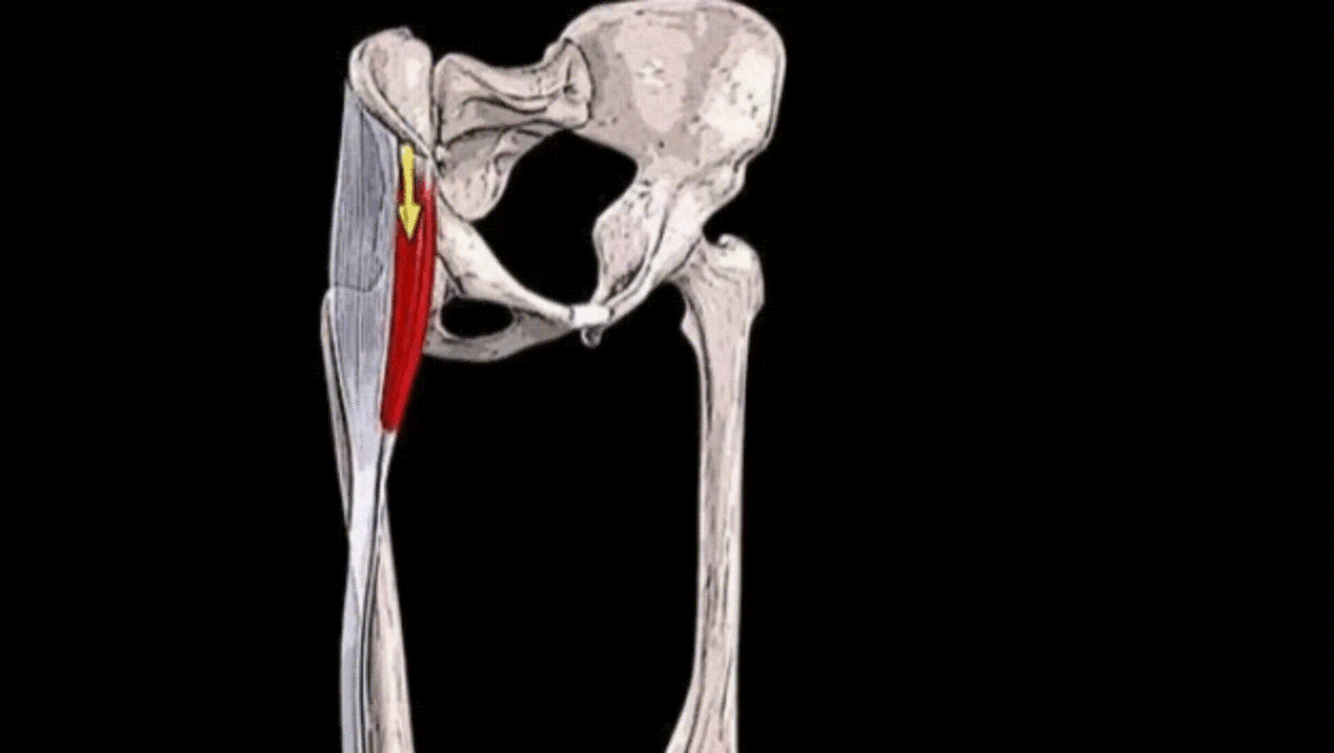Напрягатель широкой фасции бедра стабилизирует таз