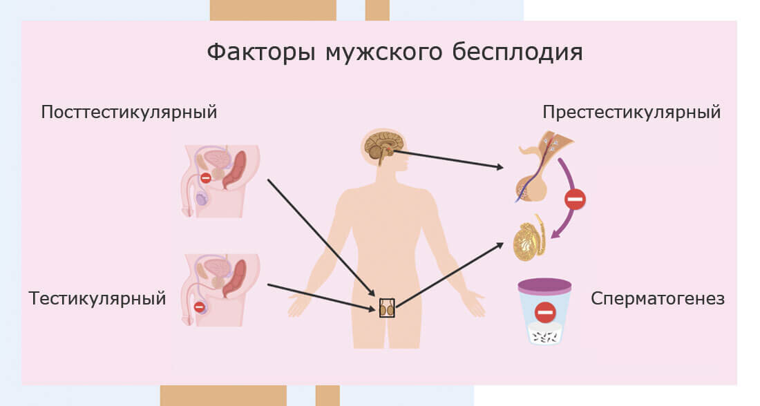 Причины мужского бесплодия