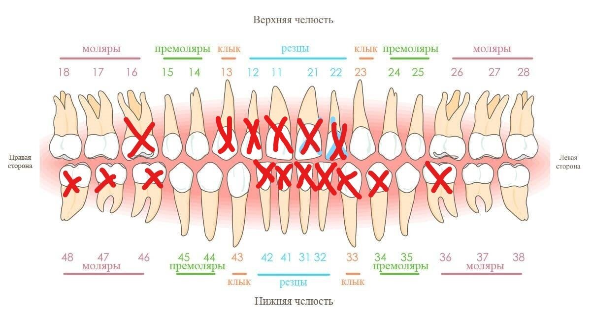 могут ли выходить зубы в 3 месяца