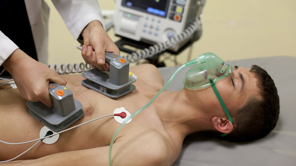 Электрическая кардиоверсия (дефибрилляция). Что такое кардиоверсия ЭИТ. Наружная электрическая кардиоверсия дефибрилляция что это такое. Электроимпульсная терапия:дефибрилляция и кардиоверсия. Что такое нд в медицине