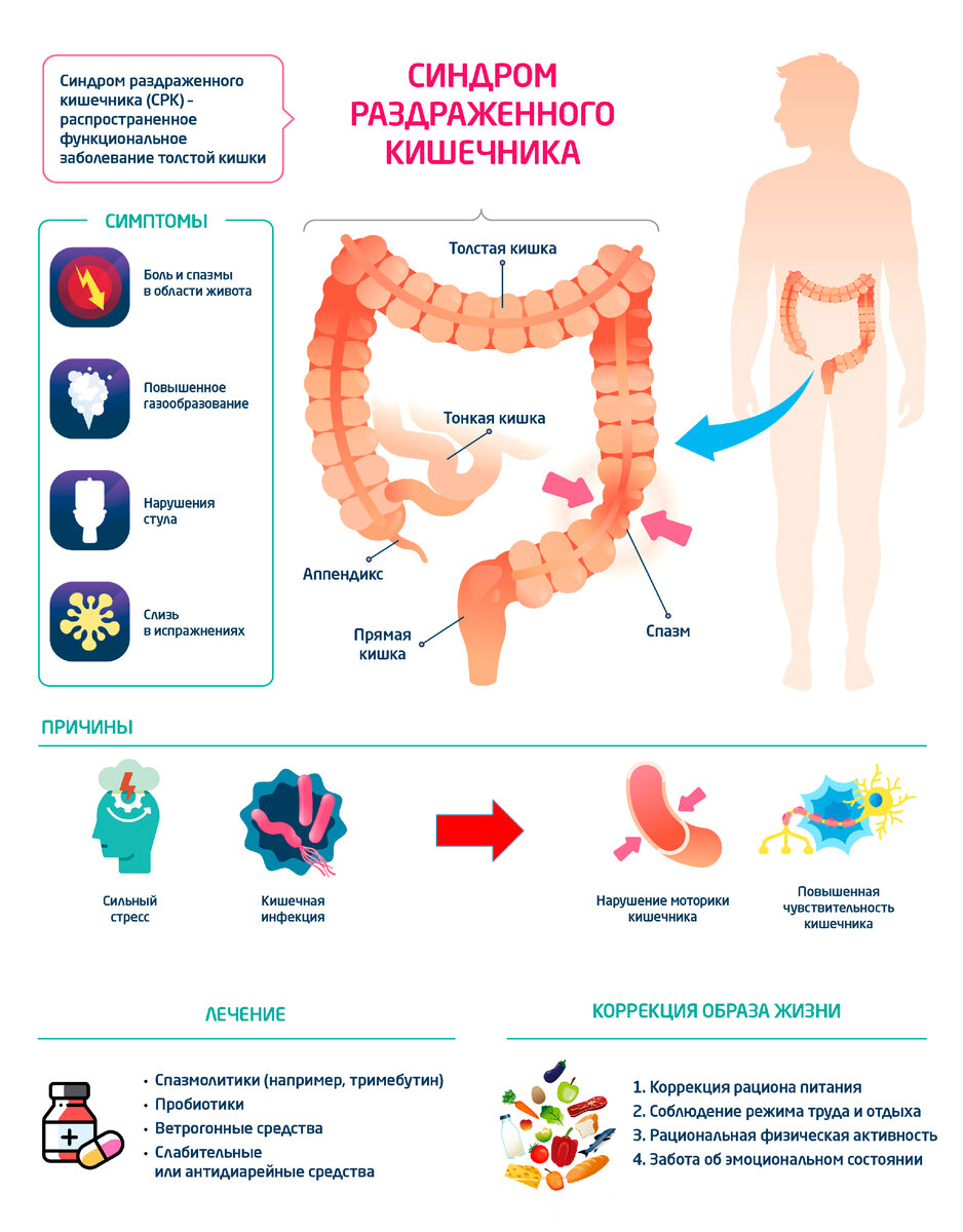 Синдром раздраженного кишечника