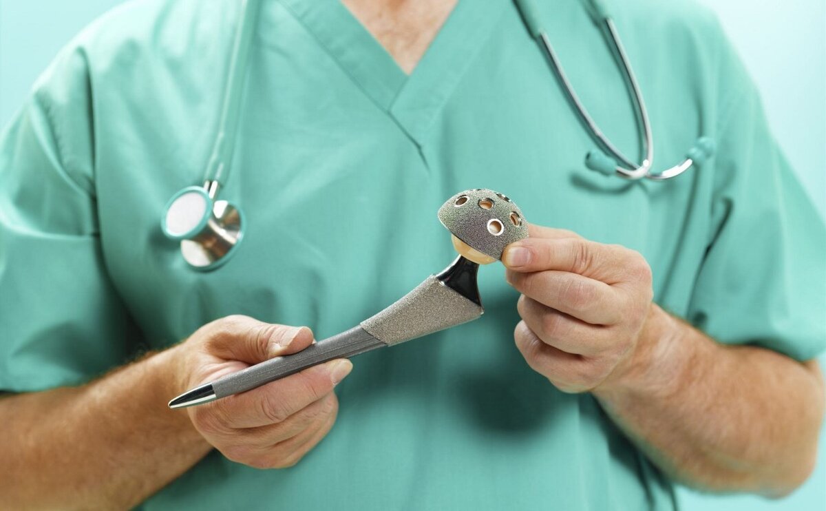 Принцип эндопротезирования тазобедренного сустава