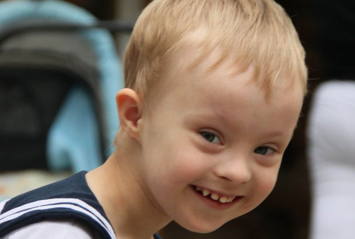 мальчик с синлрома дауна. парни дауны. парни дауны. мальчикссендромом дауна. аутизм у детей.