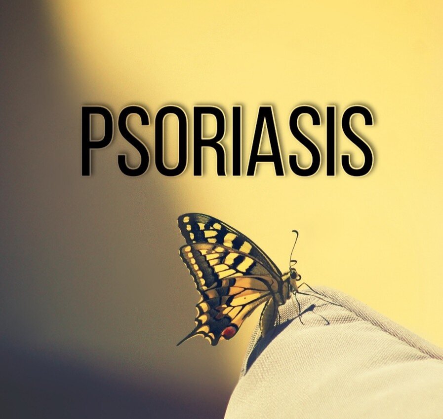 Псориаз