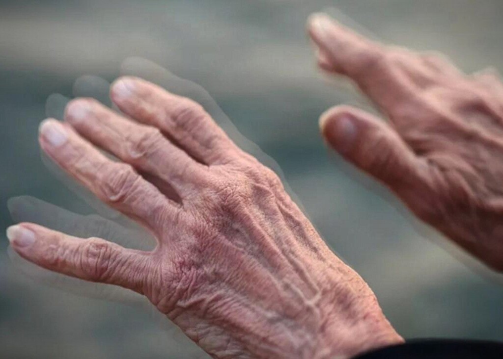 Признаки тремора рук: