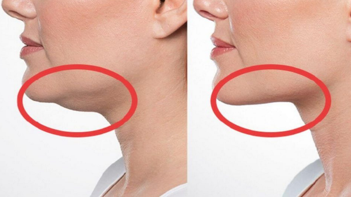 как убрать второй подбородок