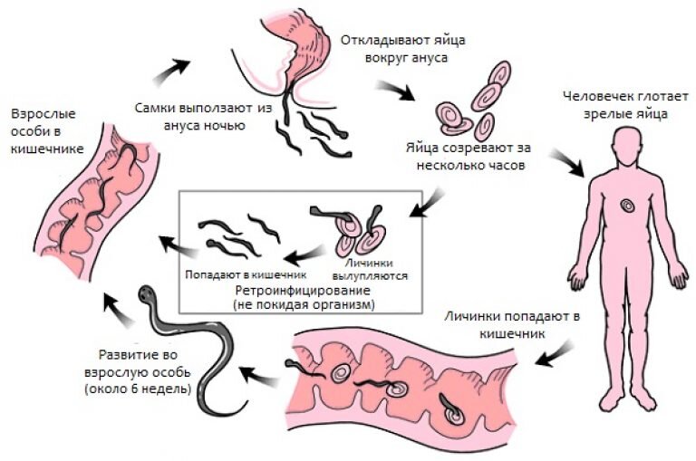 Энтеробиоз: симптомы, соскоб, лечение
