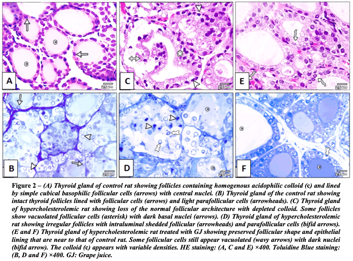 Из статьи Ayuob NN, El-Hawwary AA, Huwait EA, Mubarak WAE, Balgoon MJ. Red grape juice protects the rat thyroid gland against hypercholesterolemic changes. Ultrastructural and biochemical evidences. Rom J Morphol Embryol. 2019;60(3):921-929.