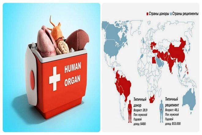 Торговля органами в Европе. Черный рынок торговля органами в России. Торговля органами (臓器売買/ДЗО:ки баибаи). Торговля органами рф