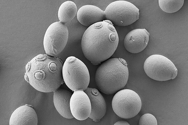 Среда обитания дрожжей преимущественно связана с субстратами, которые богаты сахарами