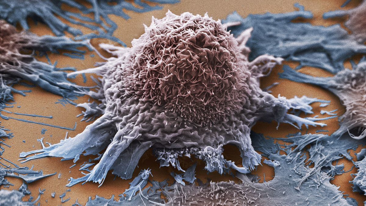 Рак - cancer