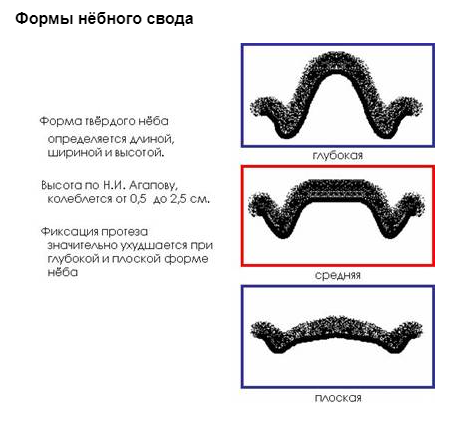 Классификация суппле картинки