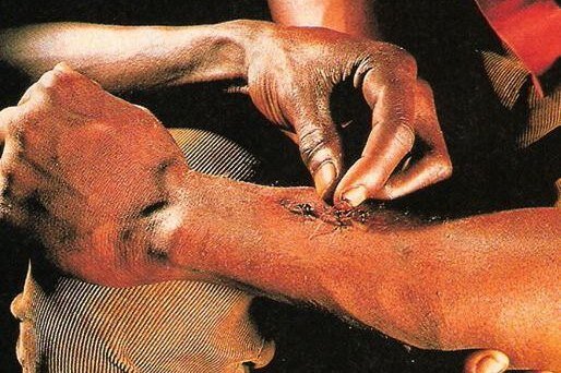     Лайфхак от туземцев: как зашить рану, если под рукой только муравьи?