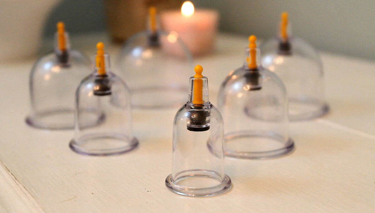 Современные банки для хиджамы. Источник: islam.ru