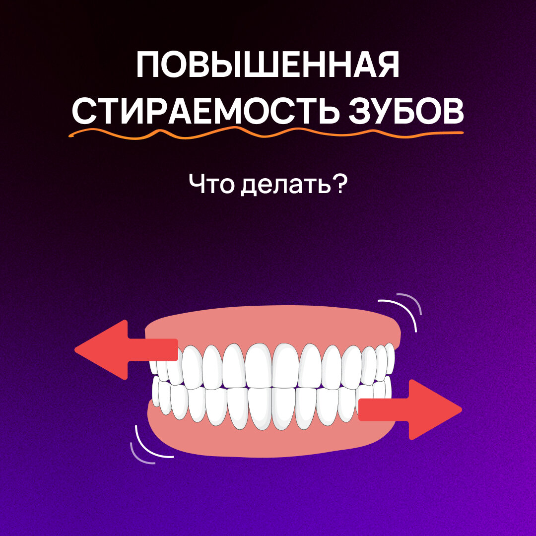 Как выглядит стираемость зубов Повышенная стираемость зубов. Что делать? Стоматологическое отделение клиники "З