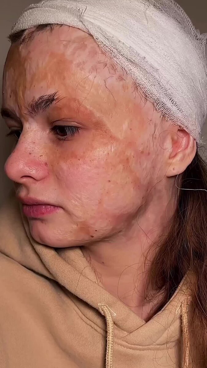    Преображение девочки Даши Видео: Инстаграм (запрещен в РФ)