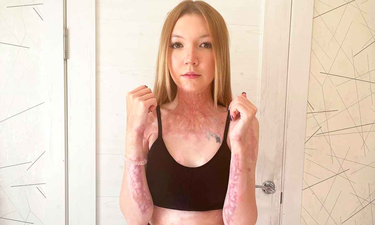 Кира Краснова, подопечная фонда "Алёша"