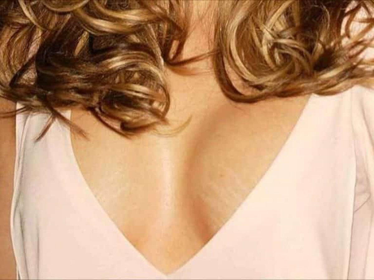 растяжки у женщин на груди фото 13