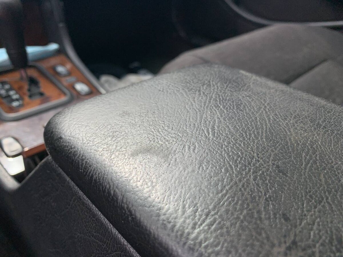 След от локтя, конечно, не исправить. Остальное - посмотрим.