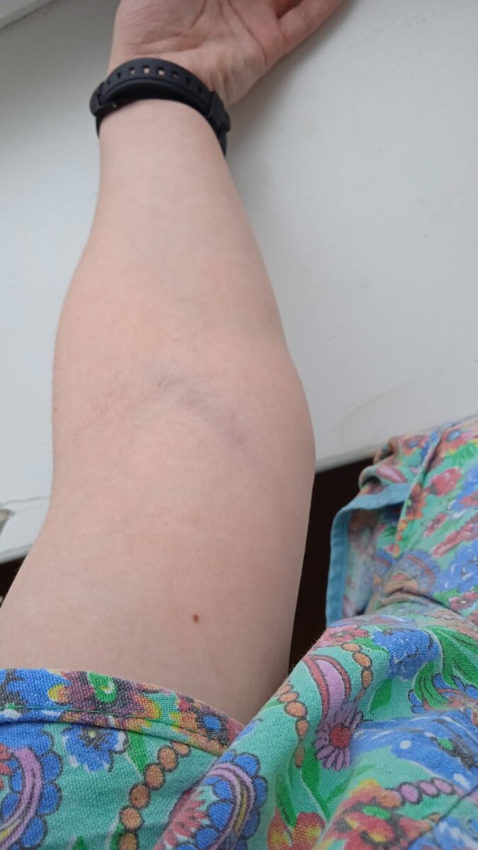 Фотография не передаст полноценно вам возмущение от моего лица