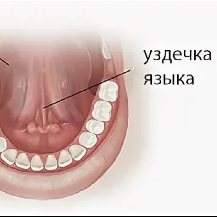 Как выглядит под языком фото