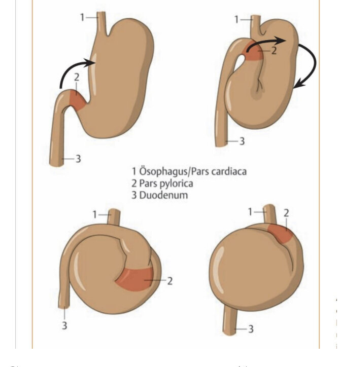 Схема заворота