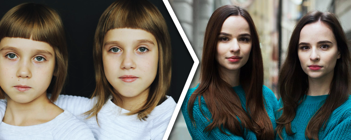 У одного из близнецов есть родинки под носом, а другой немного выше ростом.