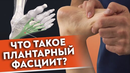 Болит пятка — что делать? Плантарный фасциит: причины заболевания и срочная самопомощь.