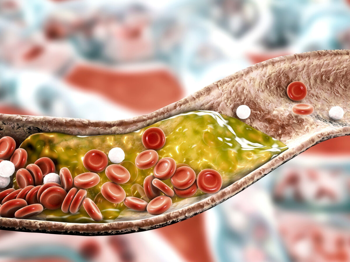 Как проверить здоровье сосудов? | Алёна Коготкова | Дзен