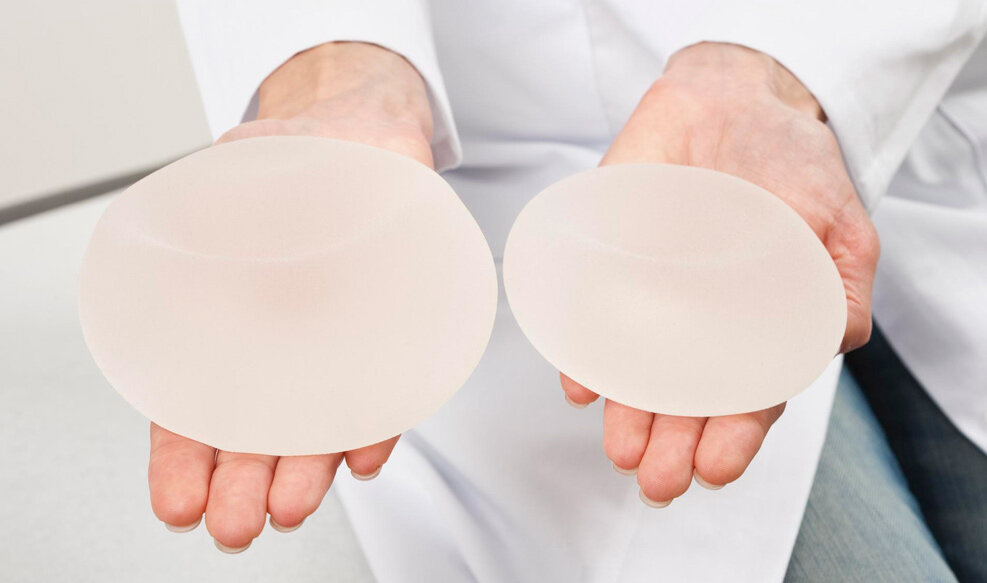 Импланты. Foto by Adobe Stock