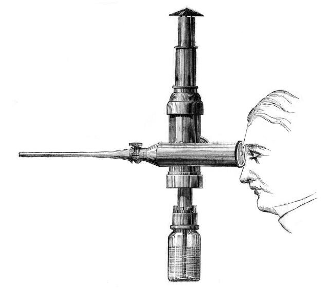 Рис1-1806 г. Аппарат Philip Bozzini 