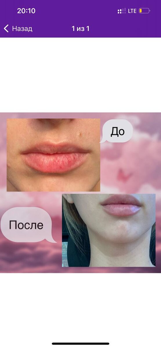 Листайте вправо, чтобы увидеть больше изображений