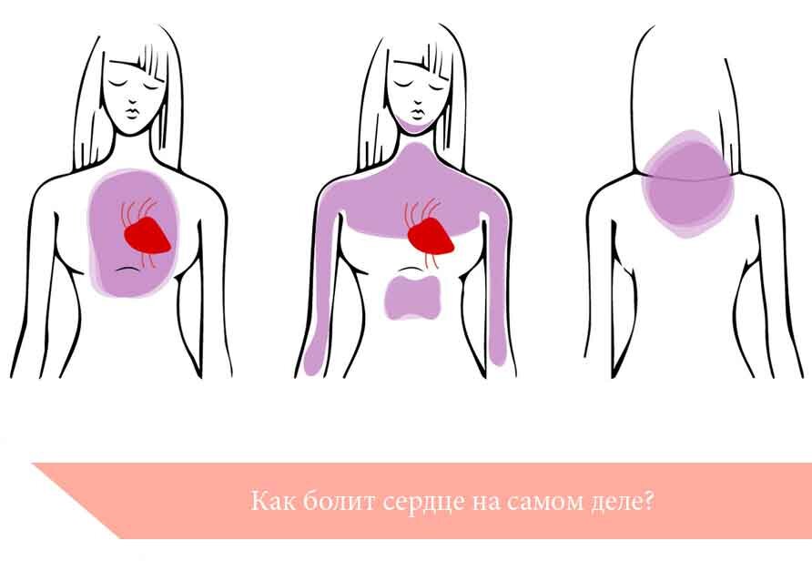 Кардиолог Яковлева: как понять, что болит именно сердце