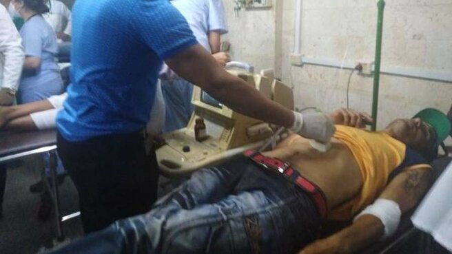 Грузовик с людьми перевернулся в пределах населенного пункта Консоласьон-дель-Сур в провинции Пинар-дель-Рио в западной части Кубы. По наименьшей мере 53 человека получили травмы. Об данном во вторник, 19 апреля, заявил новостной портал Cubadebate.

По его инфы, всех потерпевших привезли в поликлиники. Пять из их присутствуют в нелегком состоянии. Жизни других, в что количестве, 3-х не достигших совершеннолетия, ничего не грозит.

Раньше, 18 апреля, туристский автобус попал в трагедию на юге Турции — в Анталье. В итоге получили травмы 12 человек. Отмечается, собственно что перевозившее туристов транспортное средство вылетело с магистрали Манавгат–Кызылот по причине лопнувшей во время перемещения покрышки.