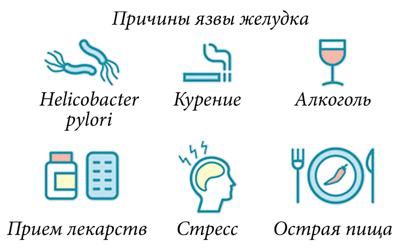 Факторы риска развития язвы желудка. Факторы вызывающие язвенную болезнь желудка. Причины появления язвенной болезни желудка. Факторы риска при язвенной болезни желудка.