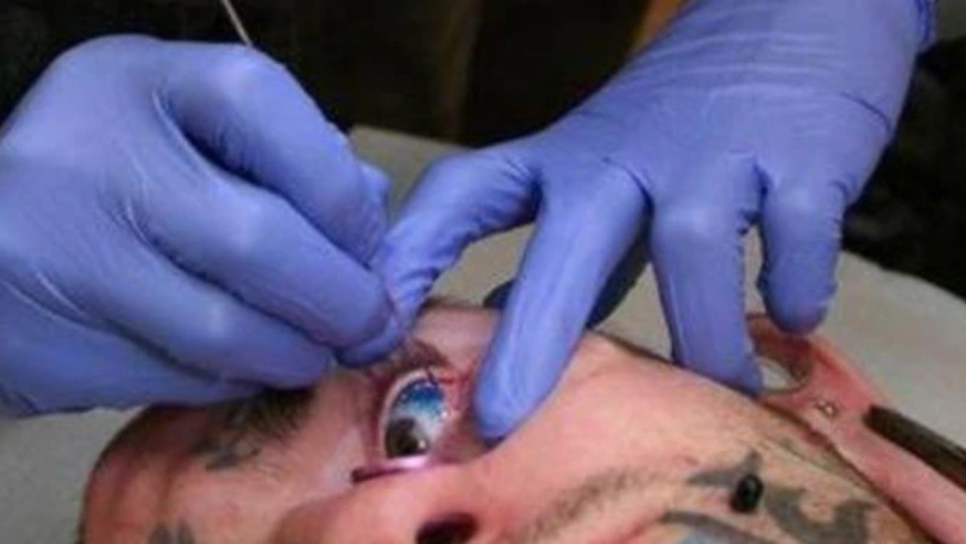 Татуаж глазного яблока