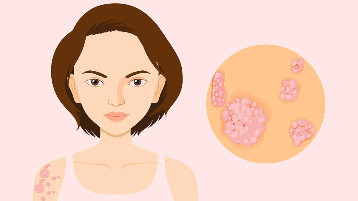 Фото MedPortal.ru