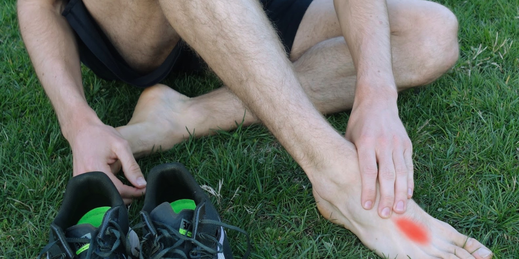 Стрессовый перелом стопы.