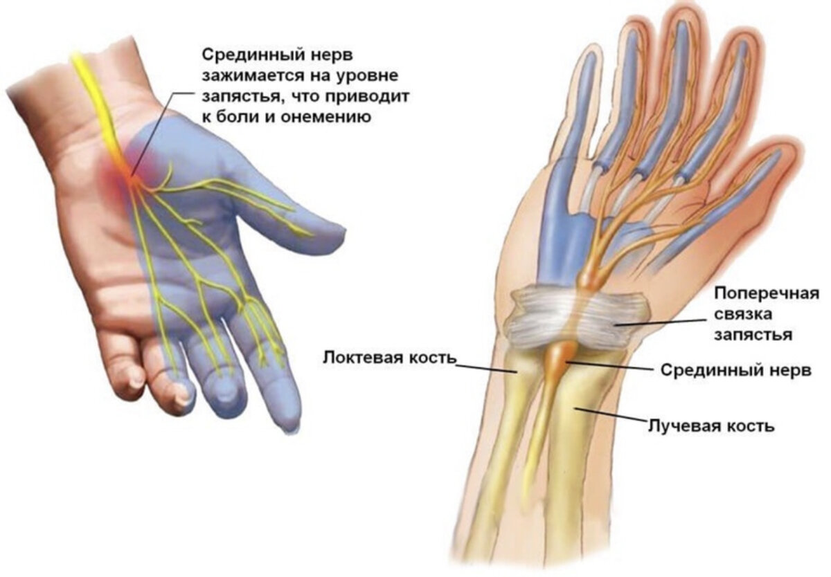 Онемение неба причины